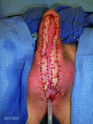 Click on image to zoom