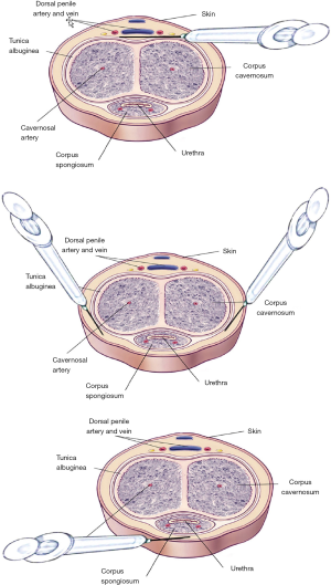 Click on image to zoom