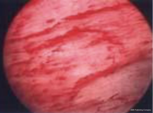 Click on image to zoom