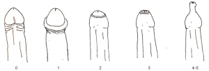 Click on image to zoom