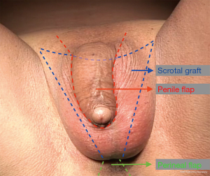 Click on image to zoom