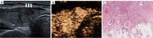 Click on image to zoom
