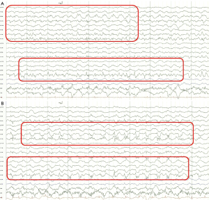Click on image to zoom