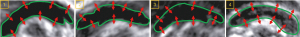 Click on image to zoom