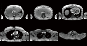 Click on image to zoom