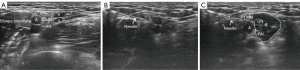 Click on image to zoom