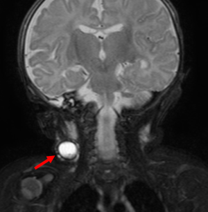 Click on image to zoom