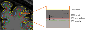 Click on image to zoom