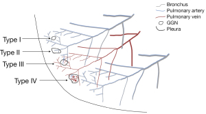 Click on image to zoom