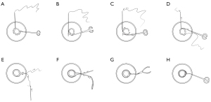 Click on image to zoom