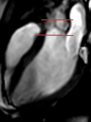 Click on image to zoom