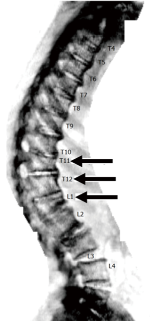 Click on image to zoom