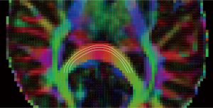 Click on image to zoom