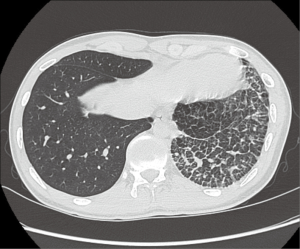 Click on image to zoom Figure 1