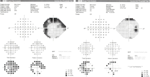 Click on image to zoom