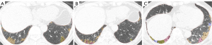 Click on image to zoom