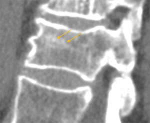 Click on image to zoom