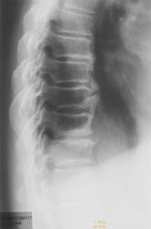 Click on image to zoom