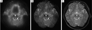 Click on image to zoom Figure 4
