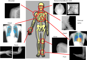 Click on image to zoom