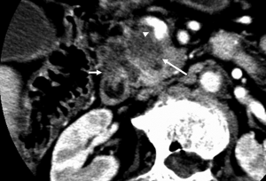 Click on image to zoom Figure 5