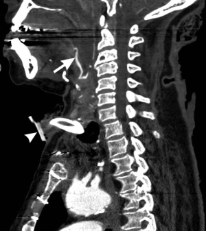 Click on image to zoom Figure 1
