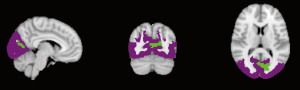 Click on image to zoom