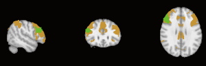 Click on image to zoom