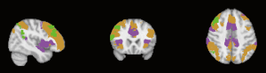Click on image to zoom