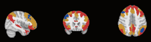 Click on image to zoom