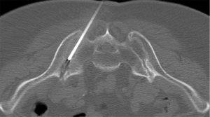 Click on image to zoom