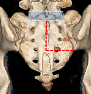 Click on image to zoom