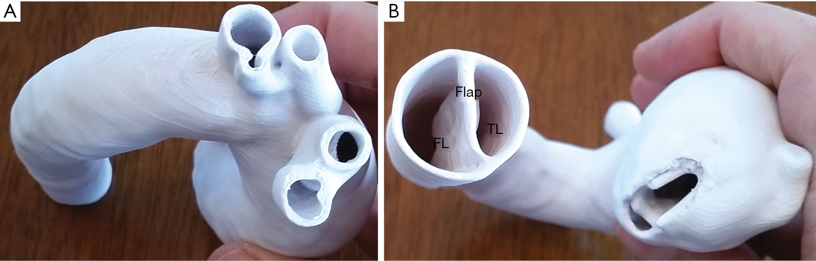 3d Printing In Medicine Current Applications And Future Directions Sun Quantitative Imaging In Medicine And Surgery
