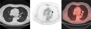 Click on image to zoom