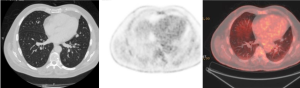 Click on image to zoom