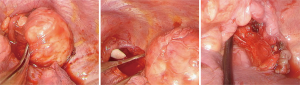 Click on image to zoom