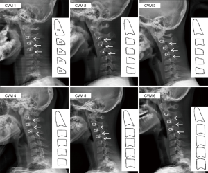Click on image to zoom