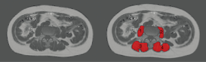 Click on image to zoom