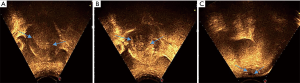 Click on image to zoom