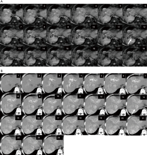 Click on image to zoom