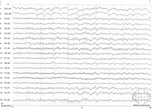 Click on image to zoom