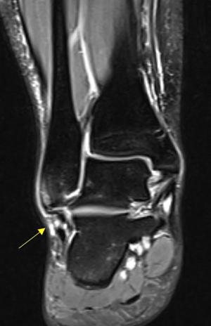 Click on image to zoom