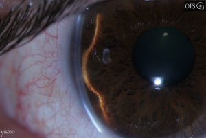 Click on image to zoom