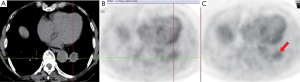 Click on image to zoom Figure 2