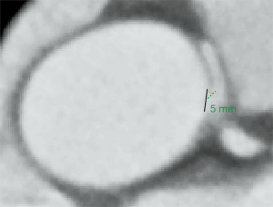 Click on image to zoom