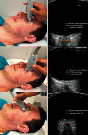 Click on image to zoom