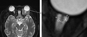 Click on image to zoom