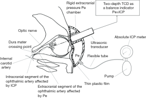 Click on image to zoom