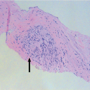 Click on image to zoom Figure 4