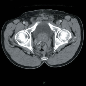 Click on image to zoom Figure 1